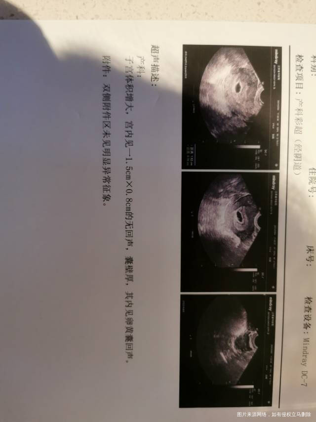 2月8号试管今天算算5周+2天孩子这个状态还