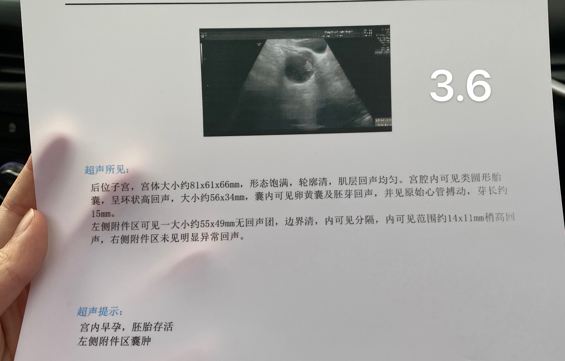 你好医生末次月经11~17现在软件显示九周了