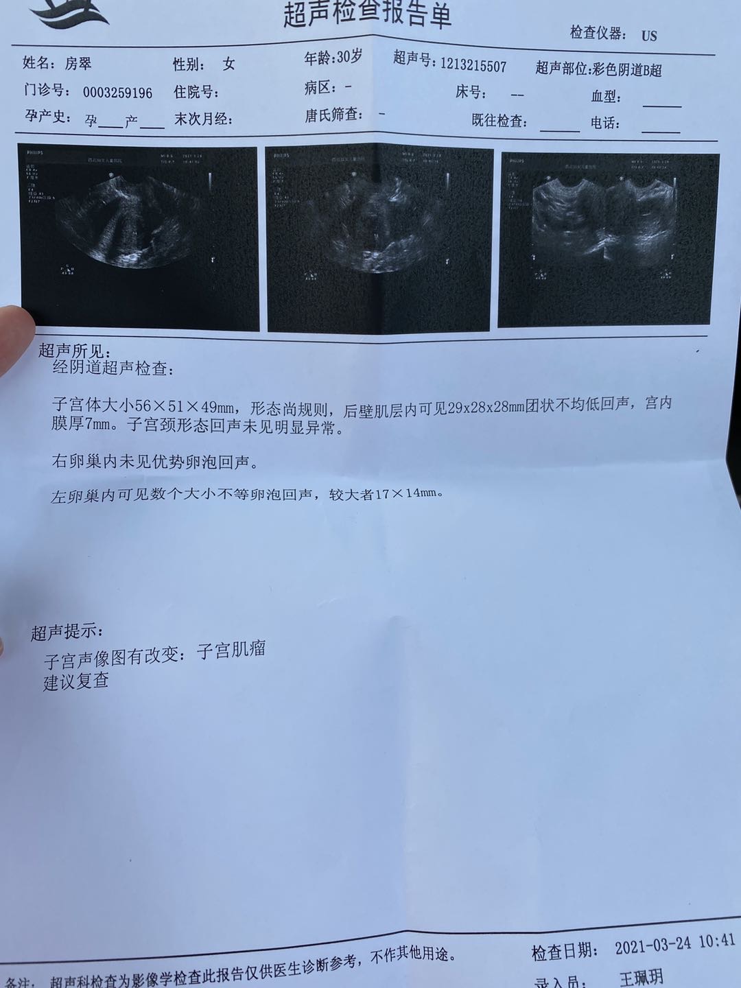 您好卵泡形状不好会不会有问题