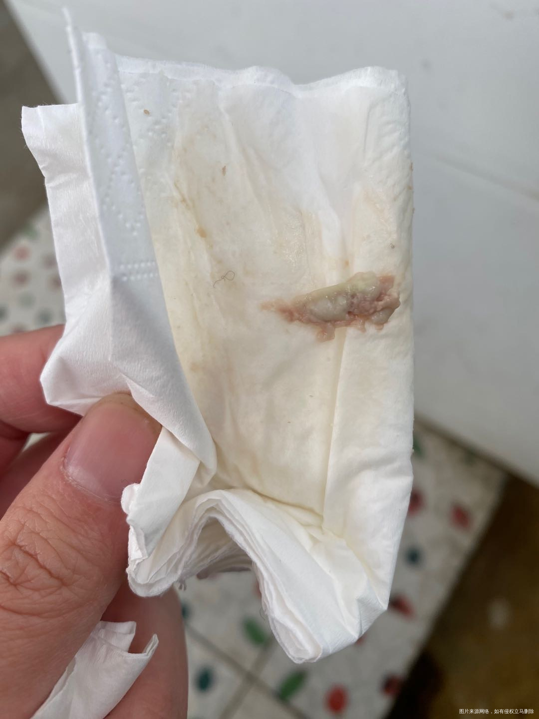 请问医生孕三个月擦出这种分泌物是怎么回事什么