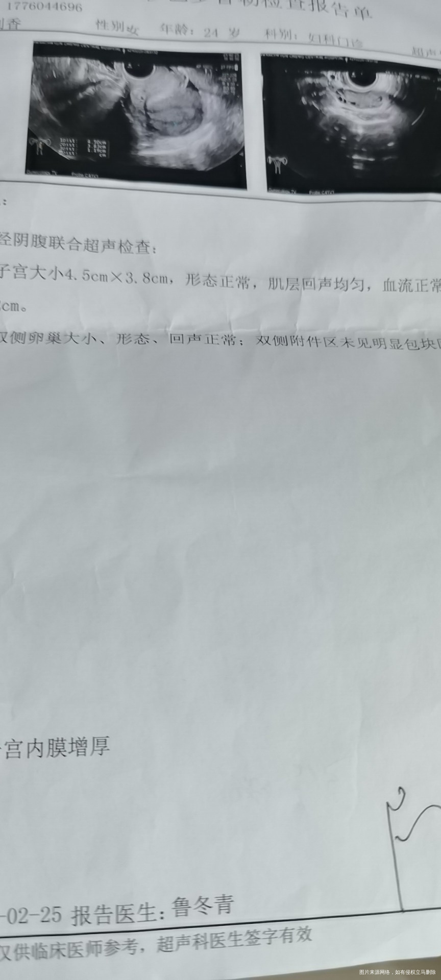 我的月经推迟了14天但没有怀孕医生开了黄体酮
