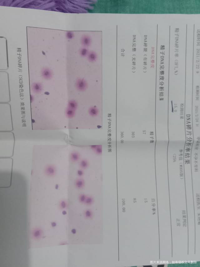 想了解一下我这正常么