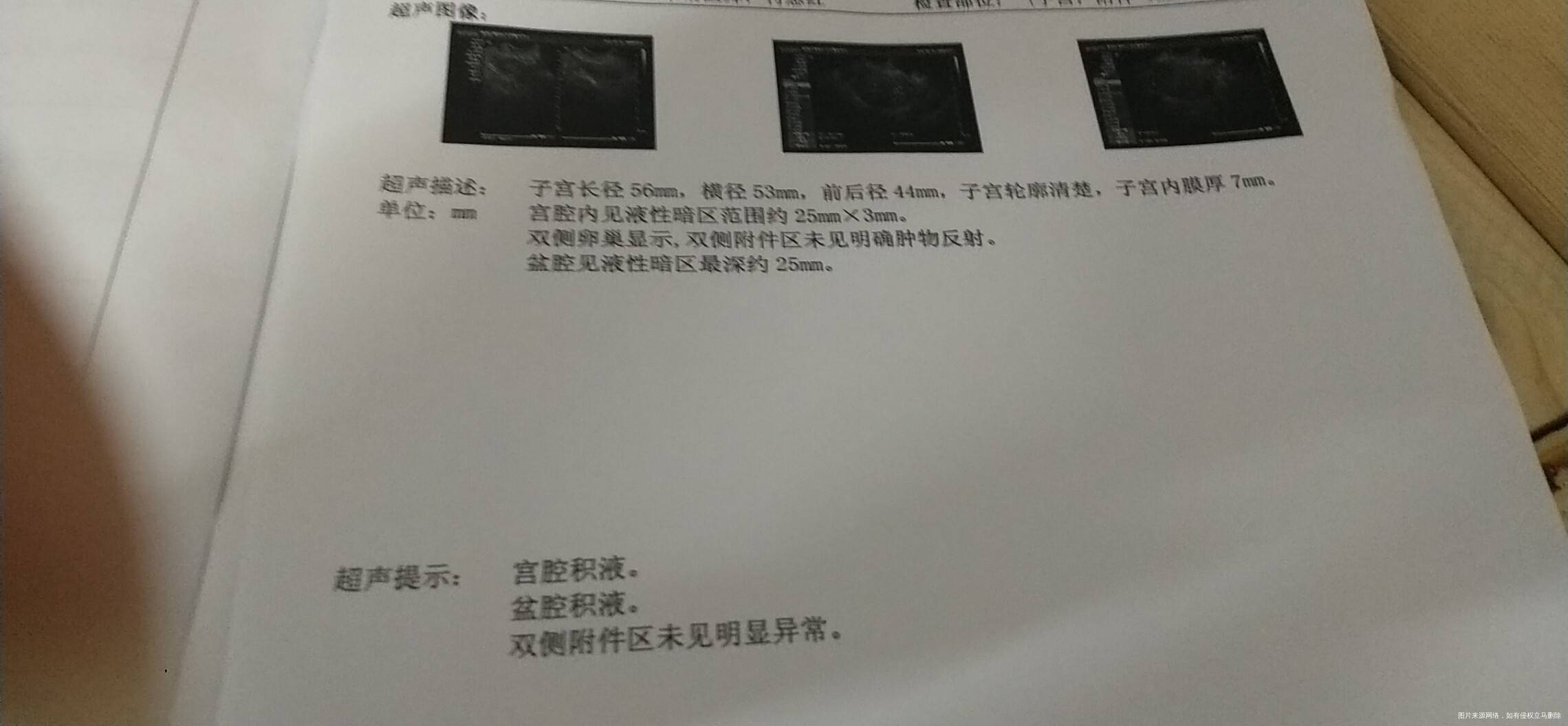 月经第三天做了个B超宫腔积液盆腔积液影响备孕