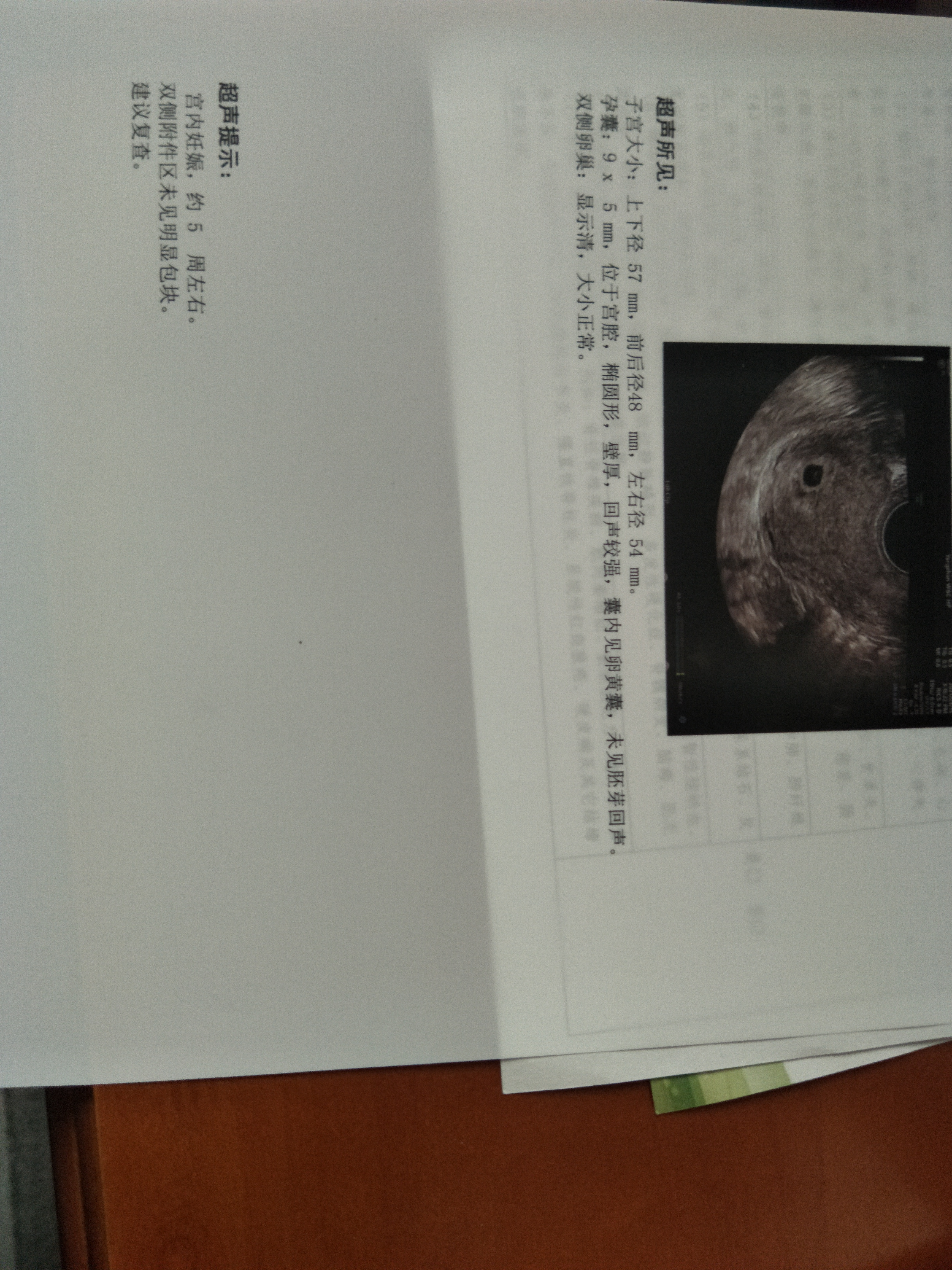 医生您好我是1月14号做了稽留流产的当时时药