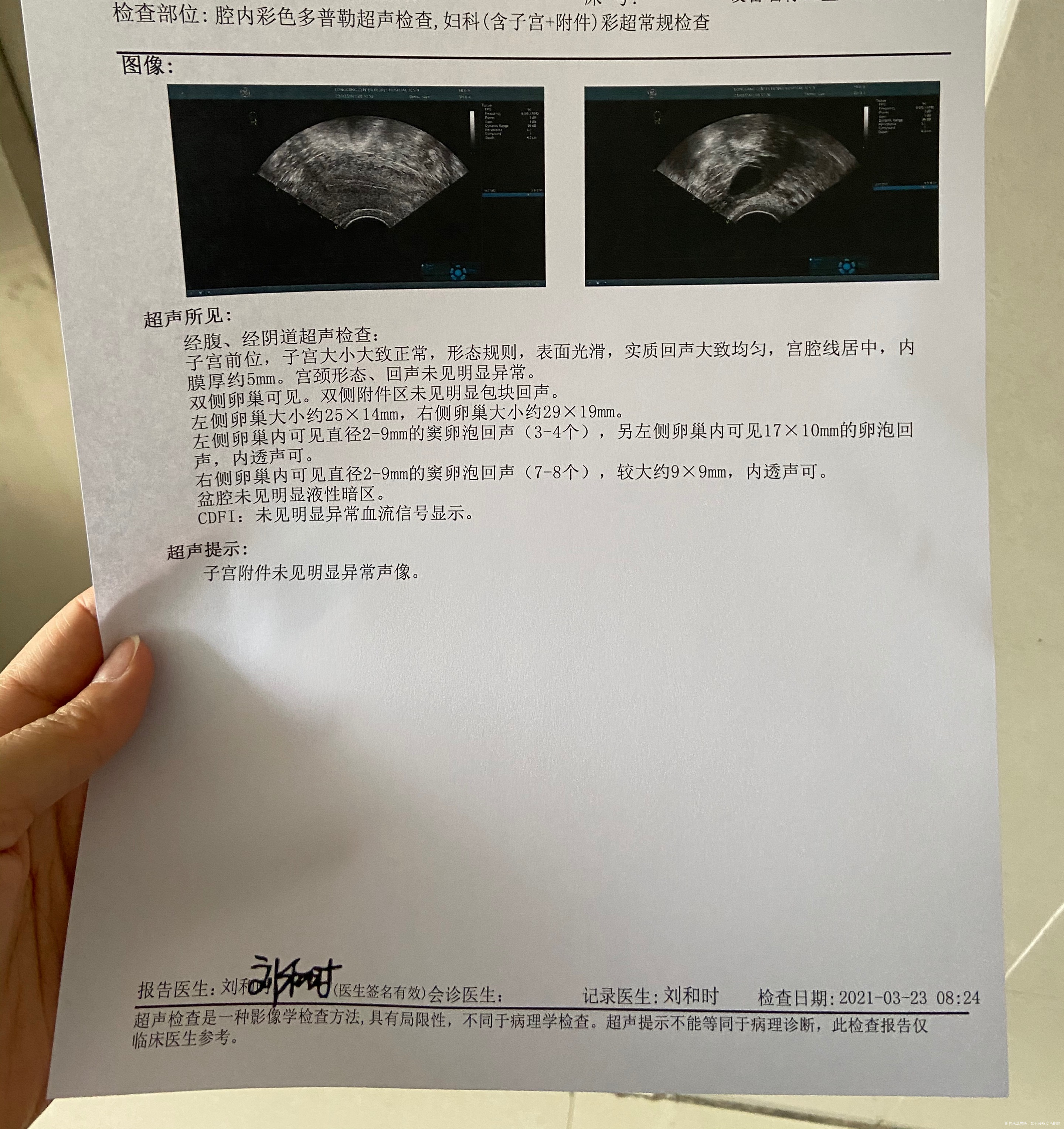 3/13来月经第一天3/14第二天去抽血检查