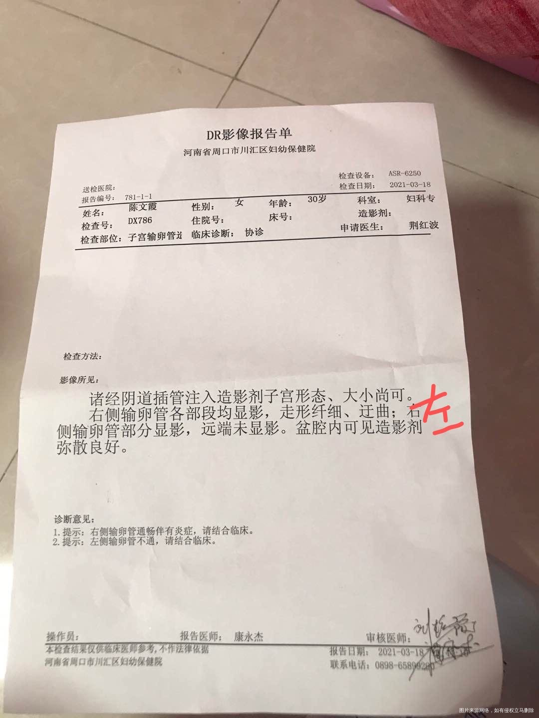 去年九月份有过一次宫外孕在右侧当时是保守治疗