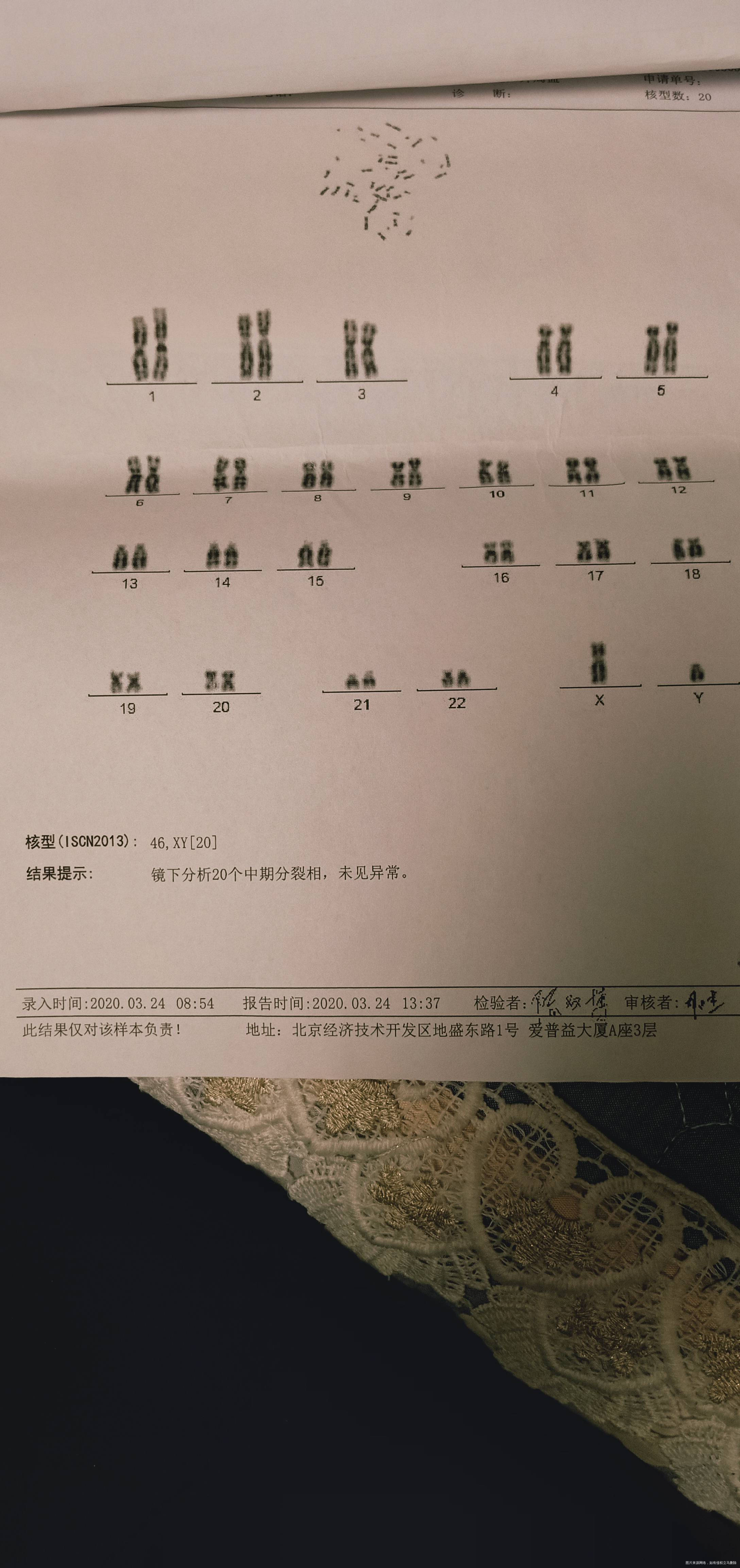 我胎停三次最后一次做了胚胎染色体十六号三体这