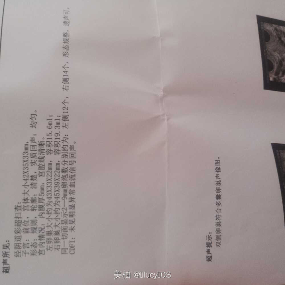 多年前刮宫过一次后来前两年检查出来多囊吃达英