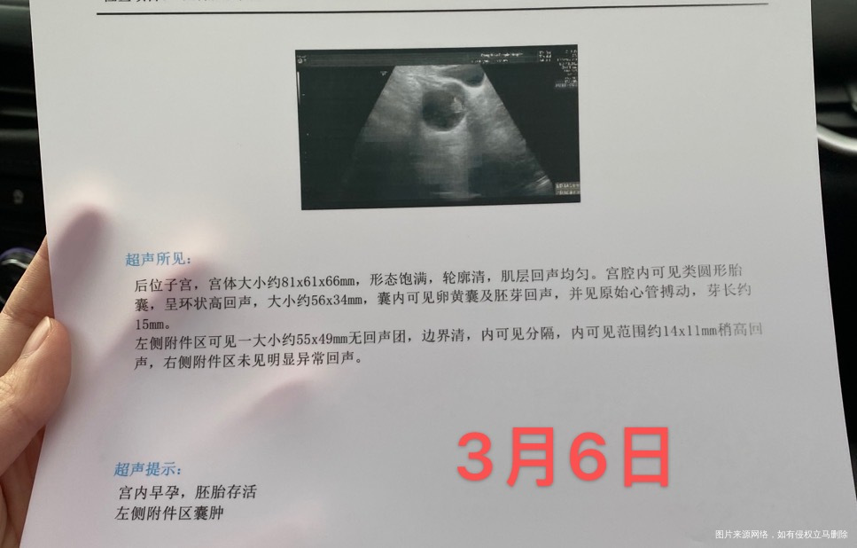 现在孕11+3b超显示胎芽的长度可能小一周算