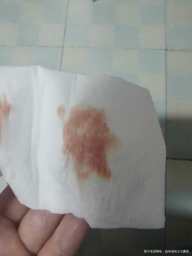 冻囊胚移植第九天有粉红色血小腹疼痛大卫一直是