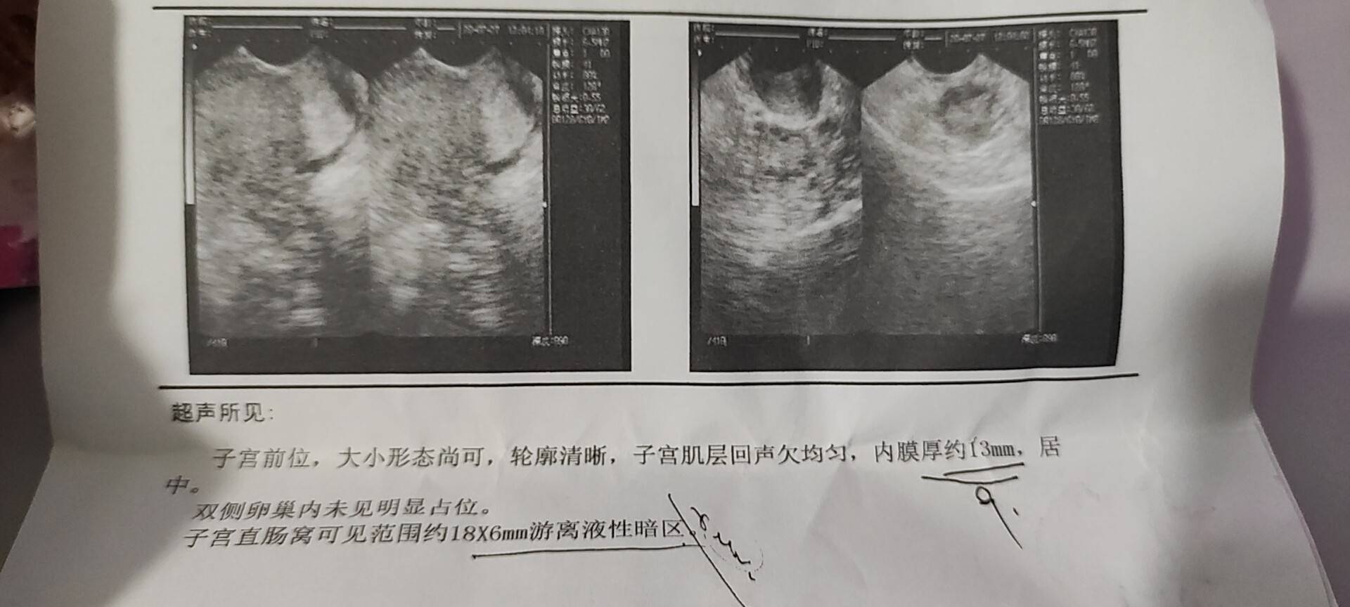 医生你好我2020年7月觉得自己月经不正常推