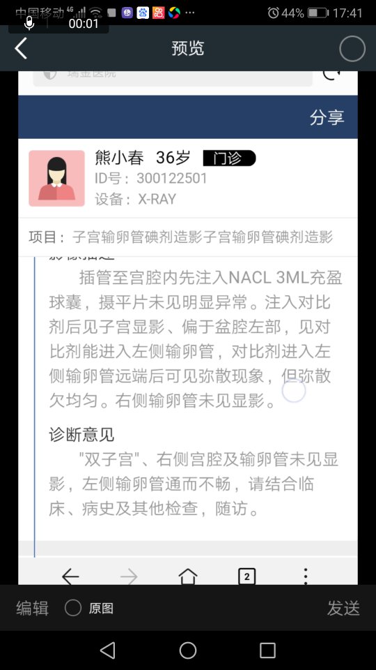 双子宫呈八字形子宫大小29x4424是不是小