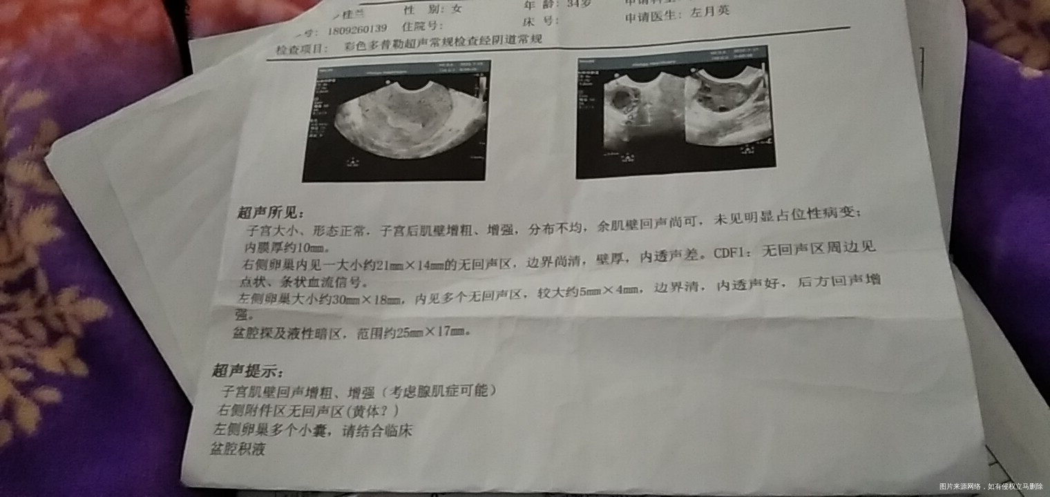 停药后月经可正常来潮请问病情严重吗