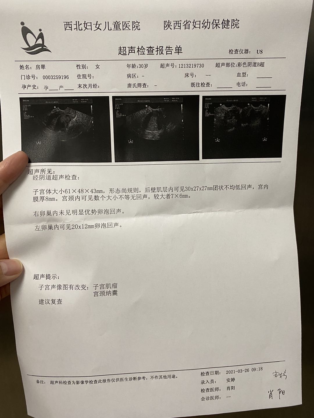 您好卵泡形状不好会不会有问题