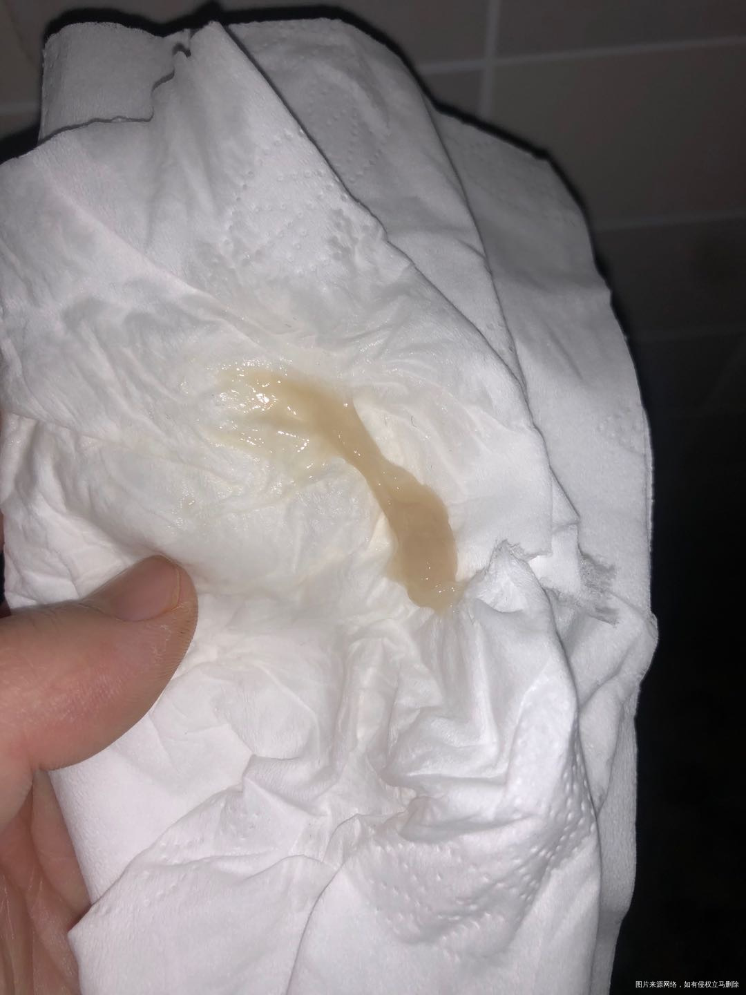 三月一号来的月经三月九号检查滴虫治疗了七天3