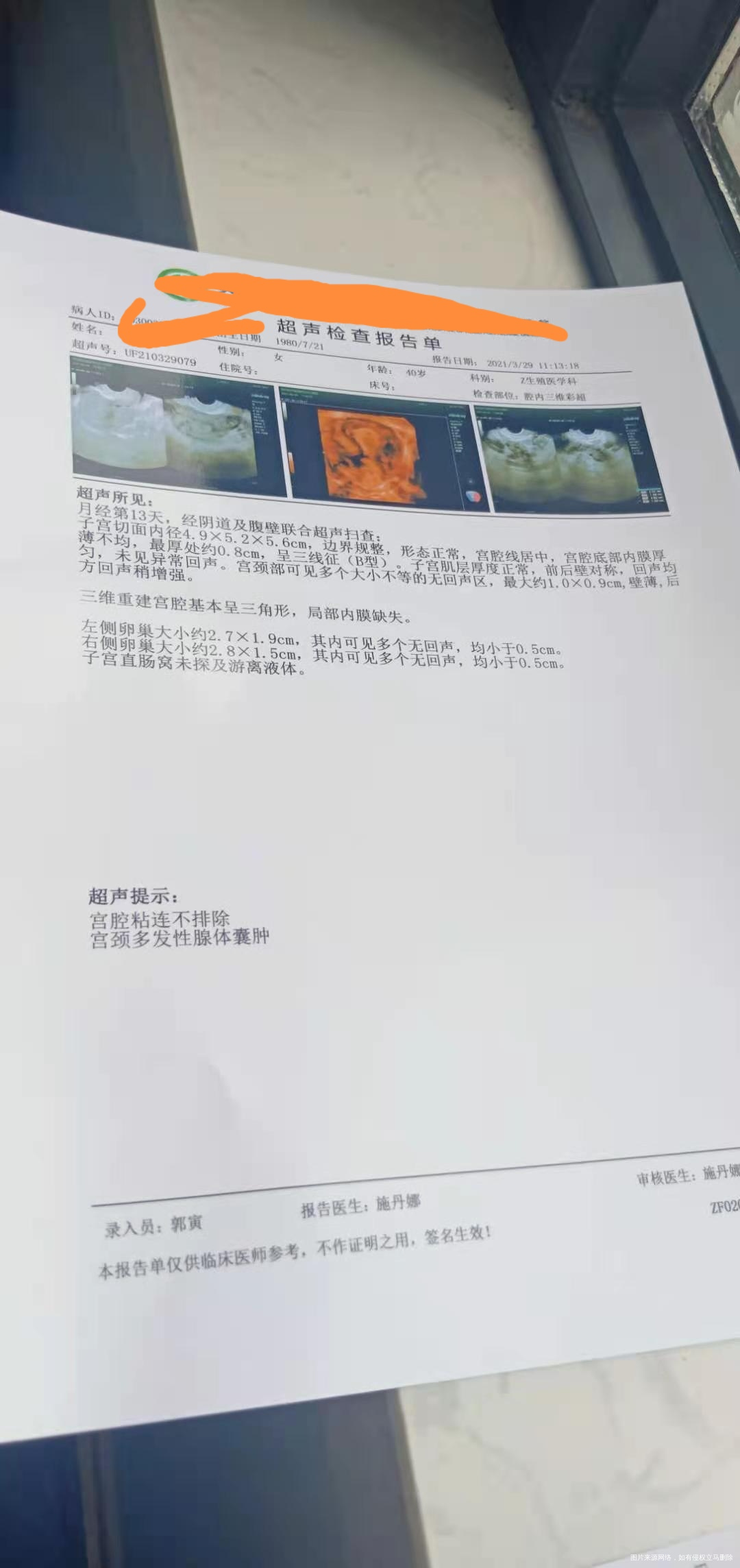 内膜有局部缺失很是担忧