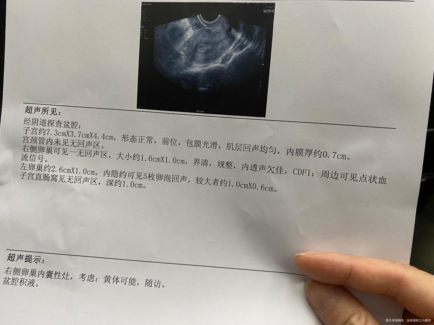 目前备孕状态目前备孕两个月过去了正在来月经月