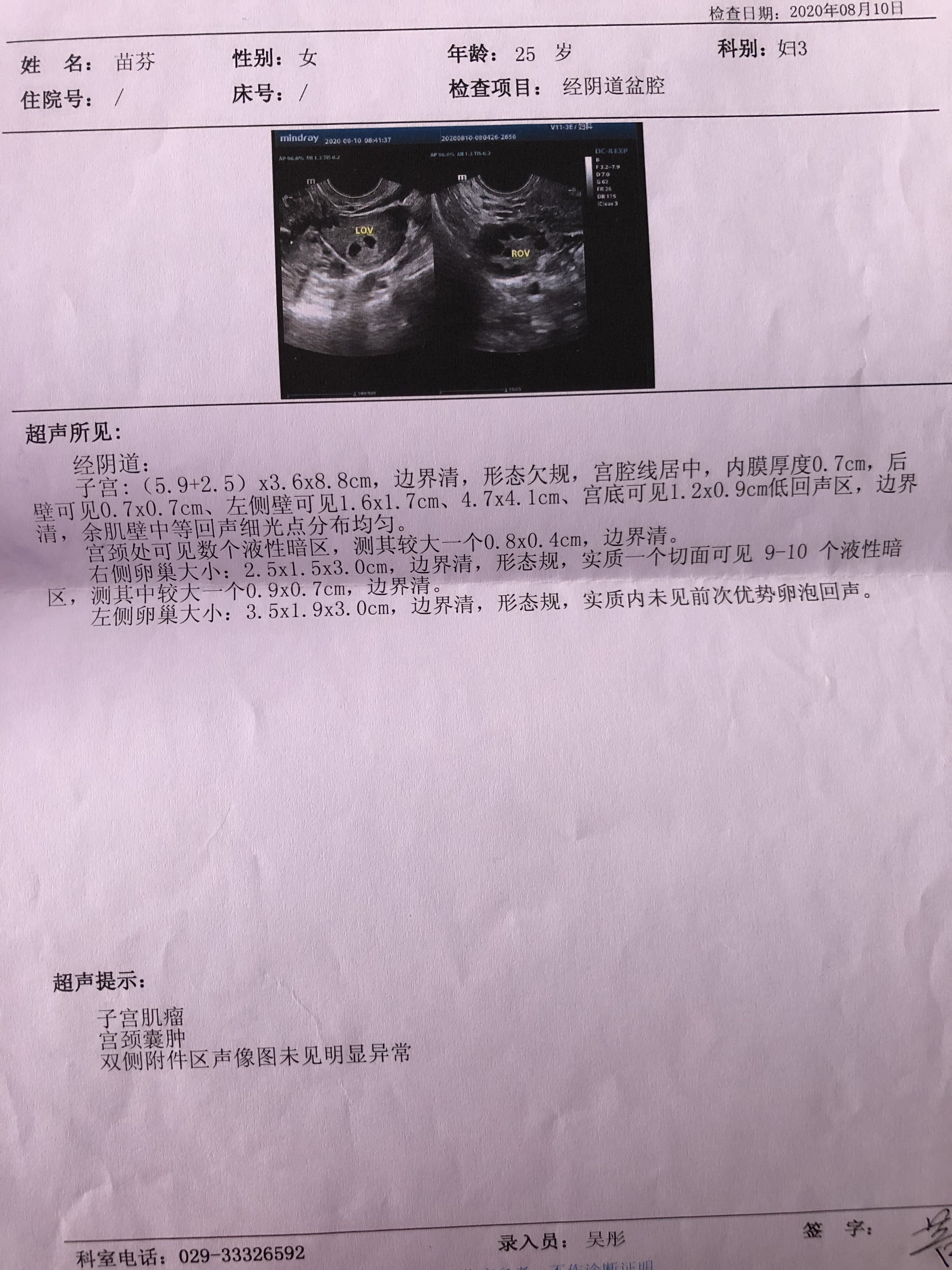 你好大夫之前检查一直有子宫肌瘤一直处于备孕期