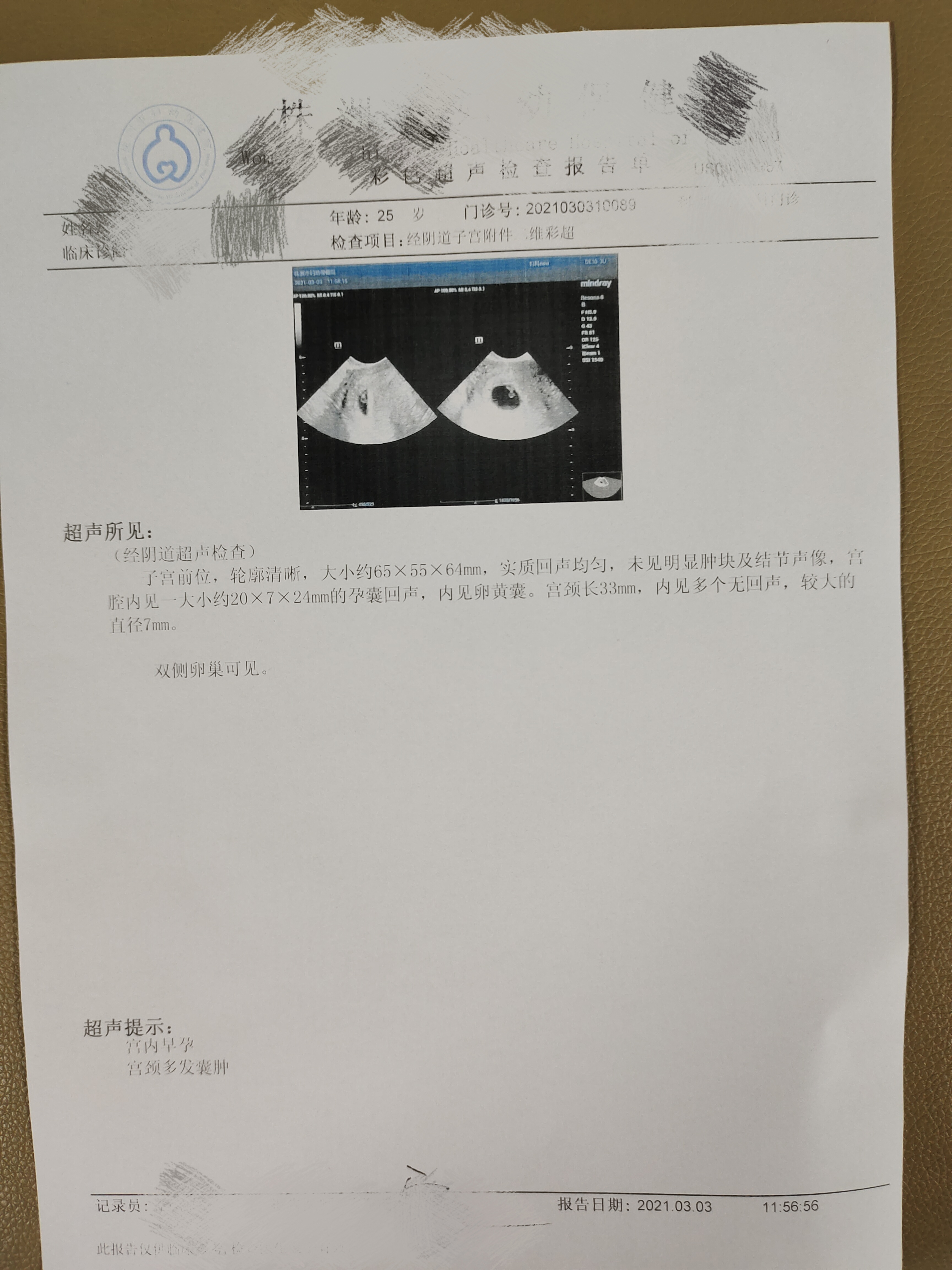 2月4号打的绒促一万这个是3-3的报告和化验