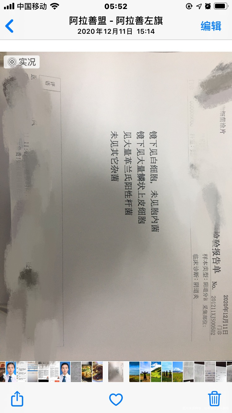 白带一直黄色有时外阴痒例假上月量少这月推迟半