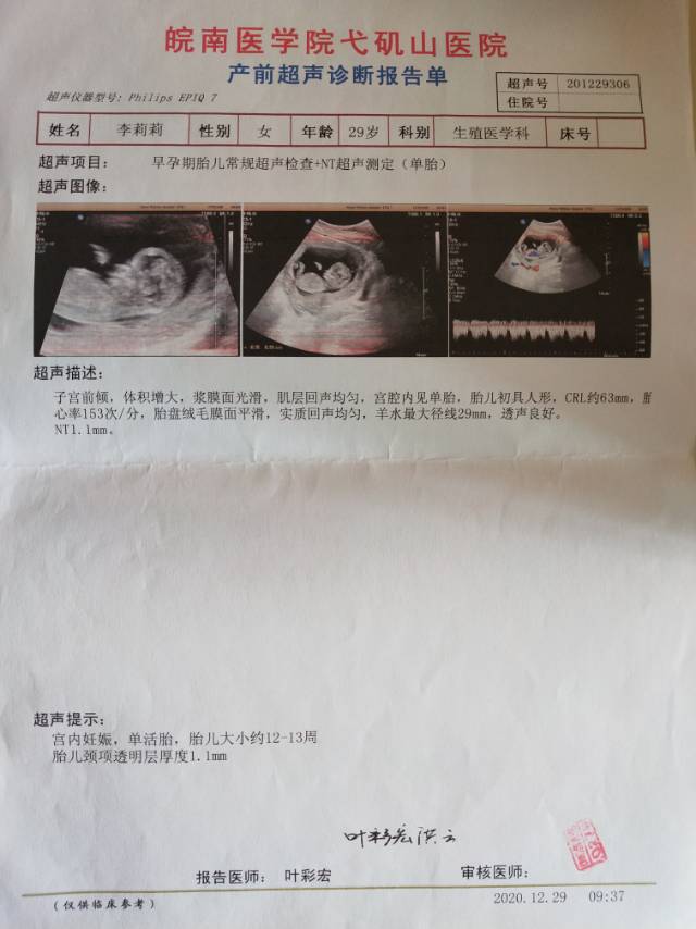 我怀孕22周+4天大排畸查出脉络丛小囊肿5m