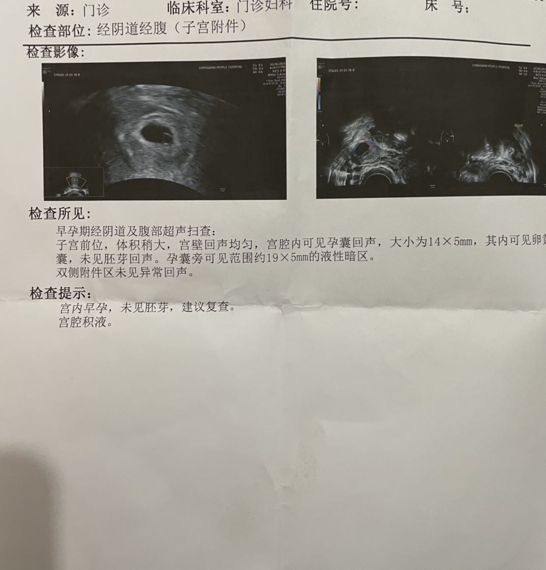 怀孕初期有液性暗区是什么原因啊