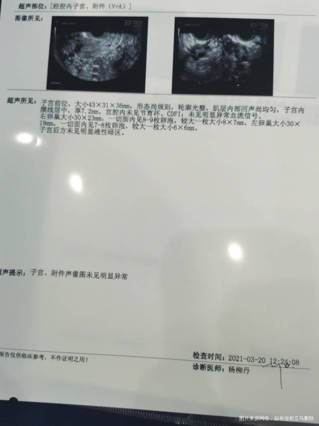 卵泡监期30天周六监测内膜72mm测卵泡6m