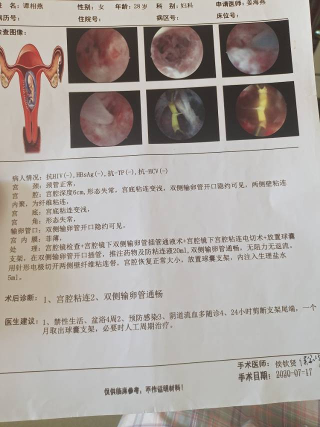 您好请问宫腔粘连术后第六第七个月月经刚干净复