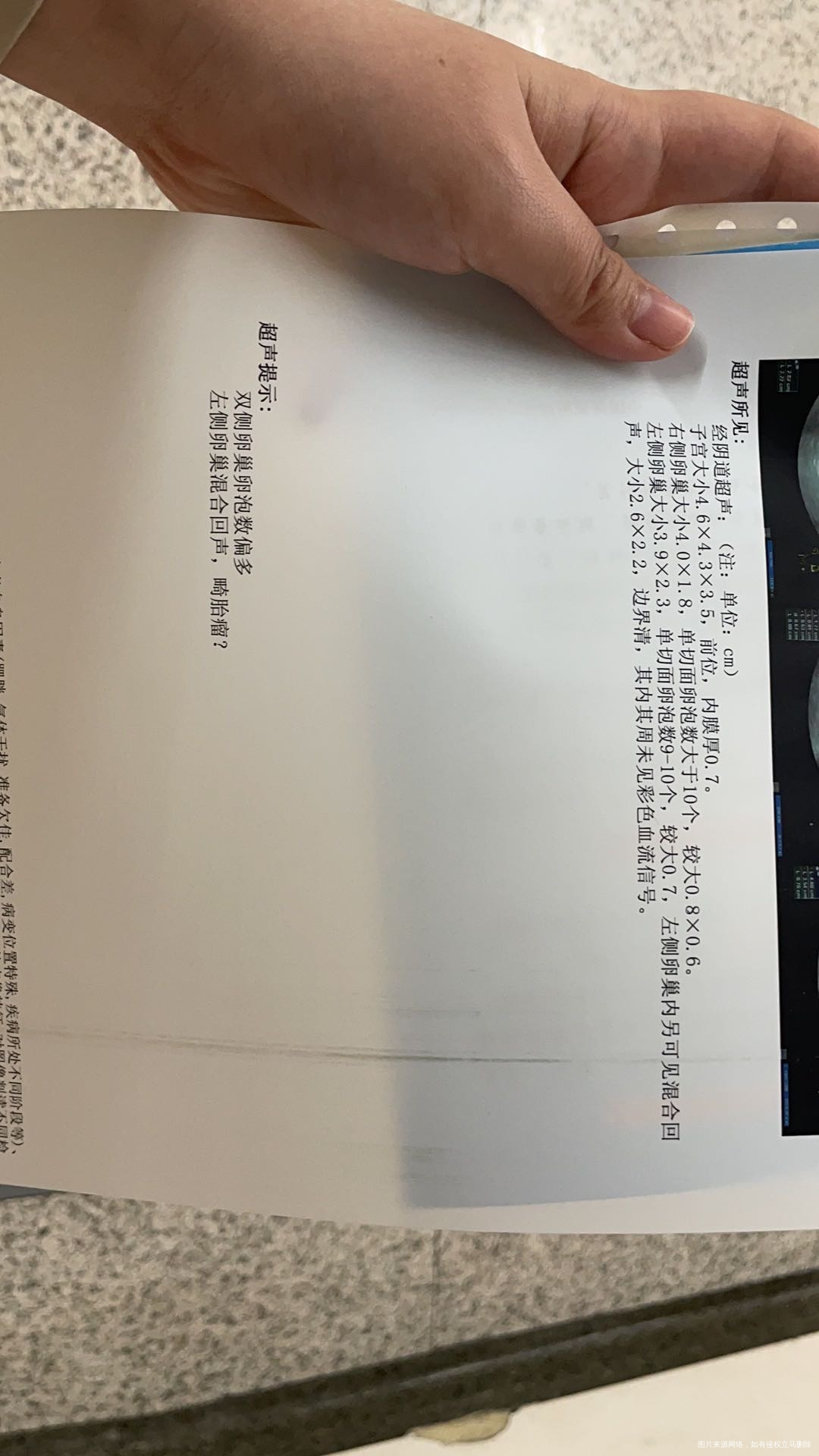 Hcg44459孕酮1689雌激素235还没