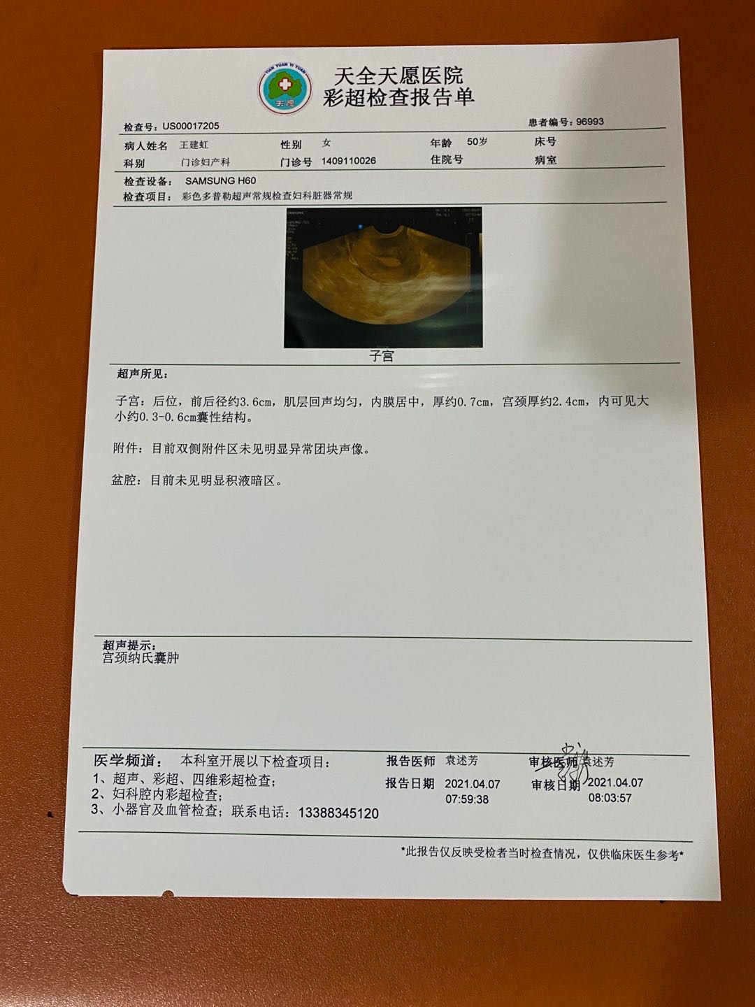 内膜07可以移植吗谢谢