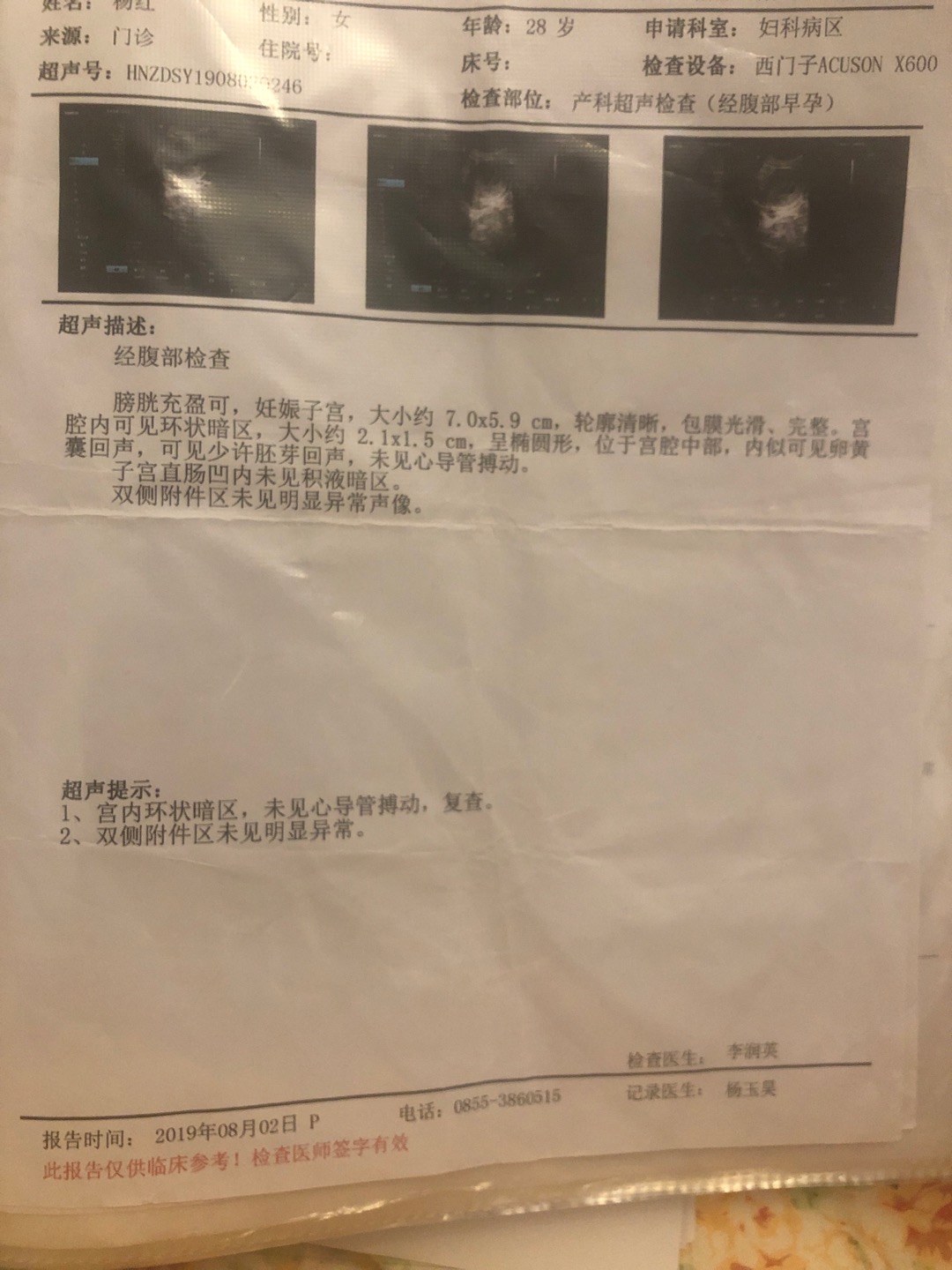 19年5月中旬因为吃螺蛳过敏输液用了甲硝唑左