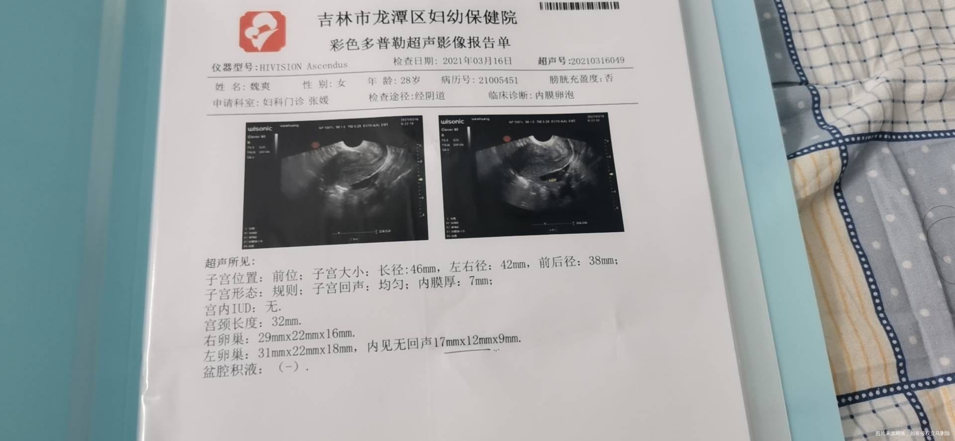 性激素六项雌二醇偏低卵泡发育慢