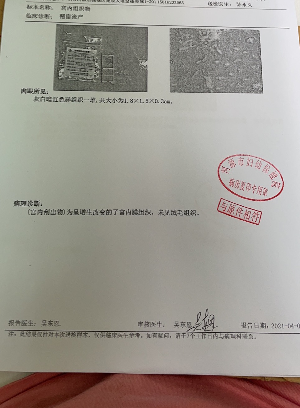 7周➕并不知道自己在家已经流掉了所以做了全麻