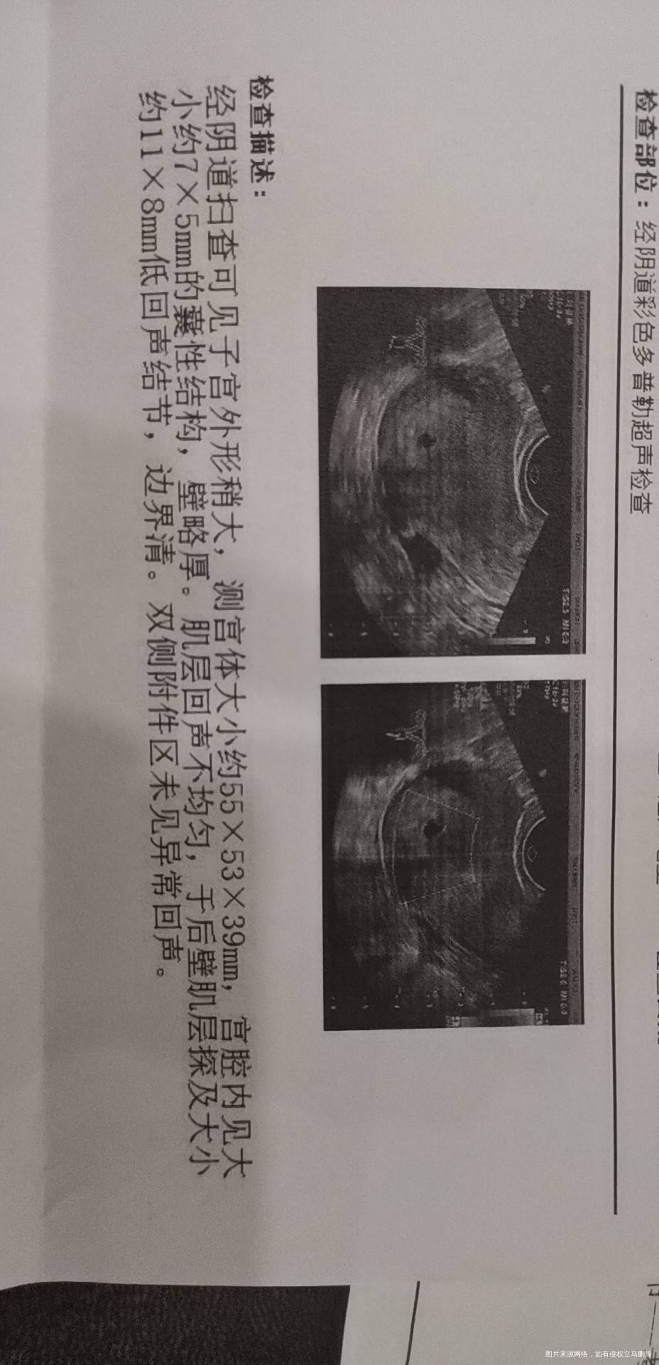 之前有过两次胎停现在怀孕了3月7号末次月经排