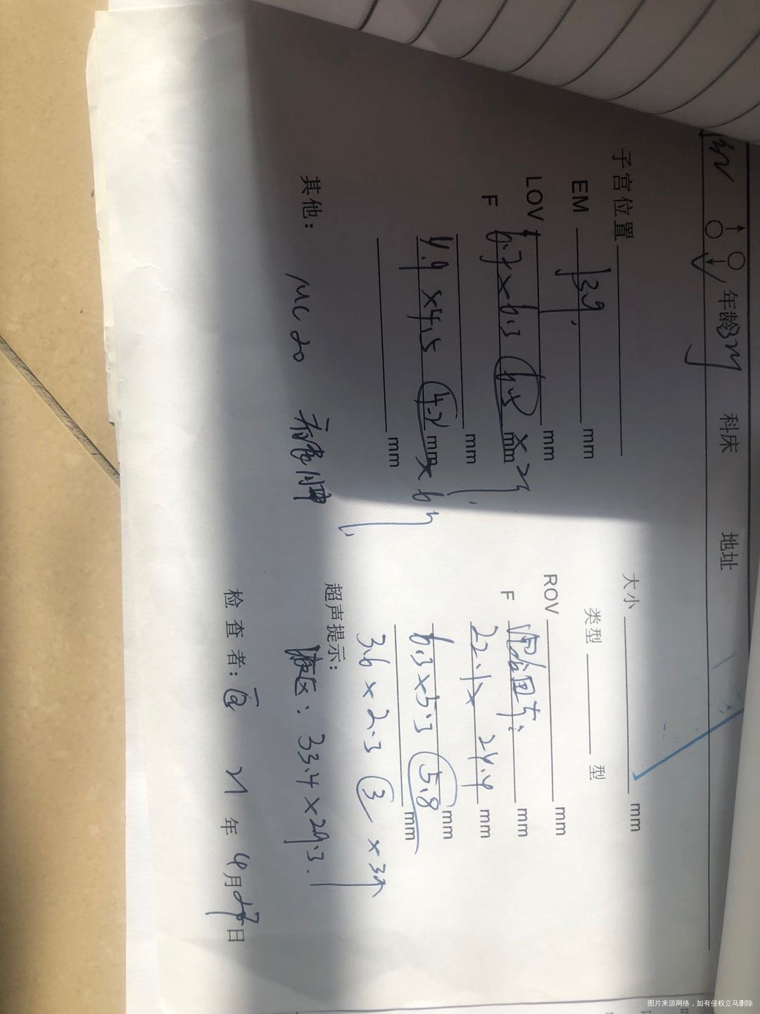 您好我这几次月经有点混乱4月8号来月经第五天