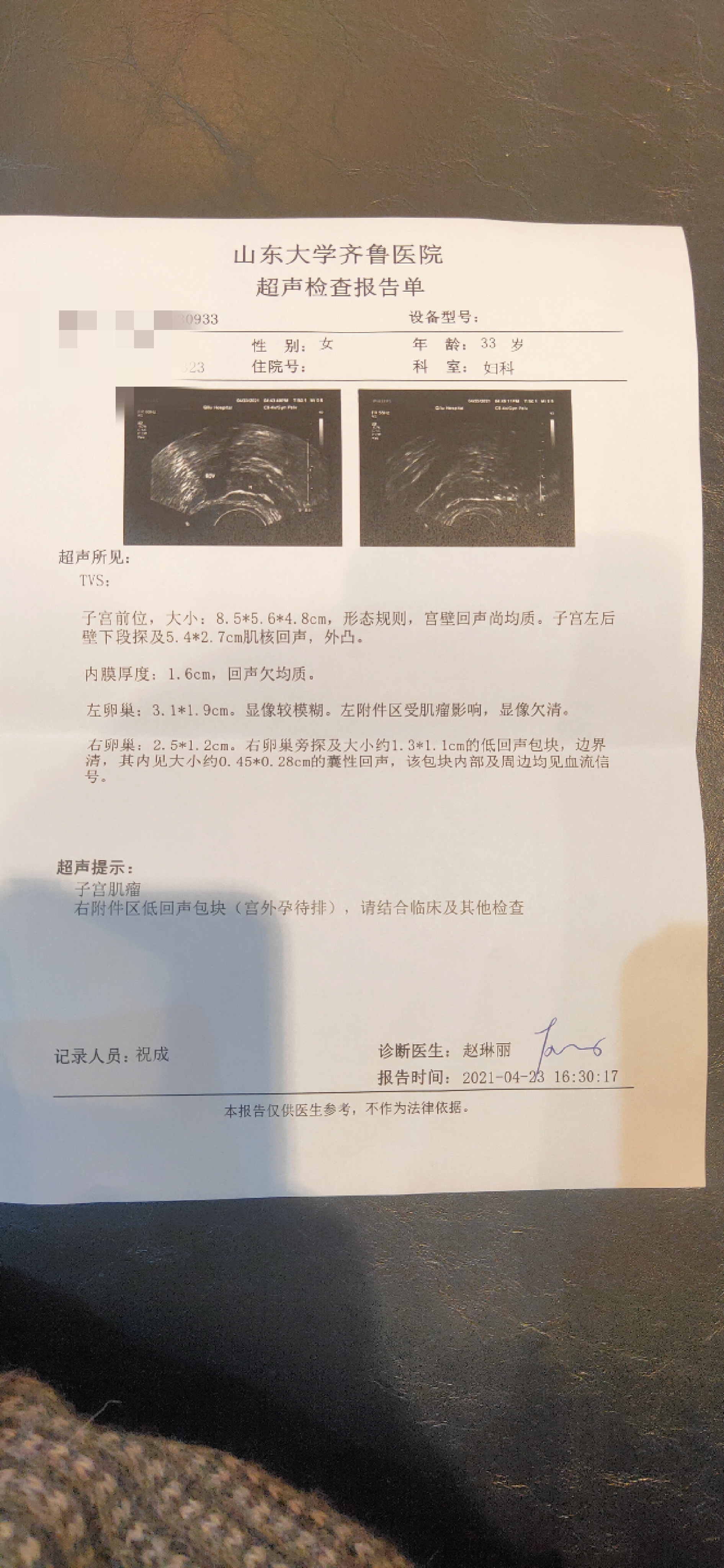 宫外孕还有一个子宫肌瘤请问腹腔镜可以做掉子宫