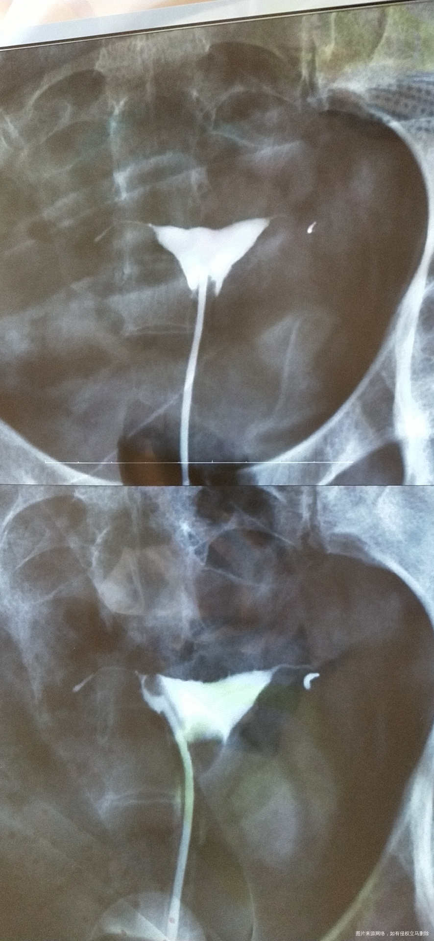 请问一下我还能不能治好