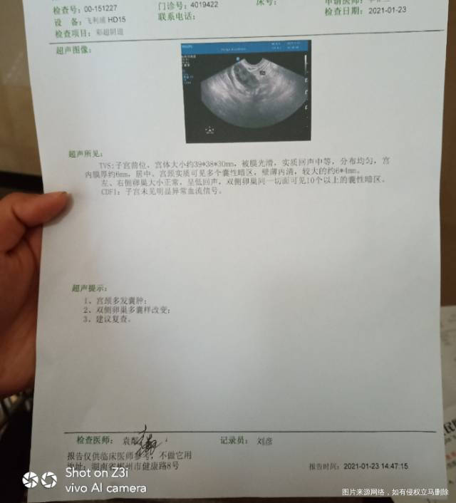 我有多囊吃药就来月经不吃药就不来月经正在备孕