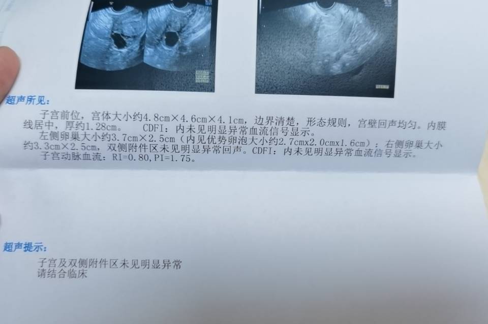 之前做过的性激素六项检查睾酮有点高身体多毛超