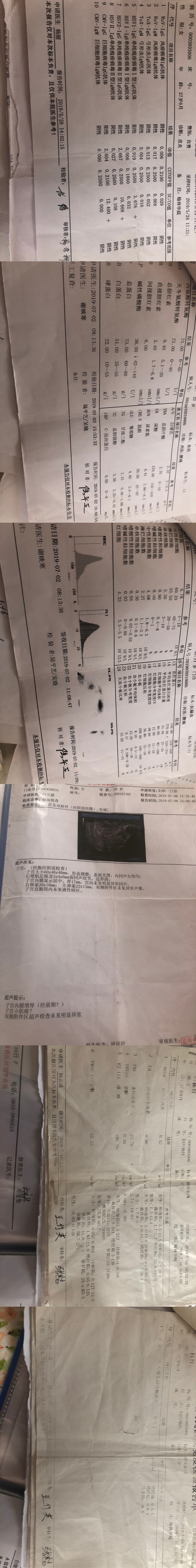 前3张检查是19年8月前后第一次怀孕先兆流产
