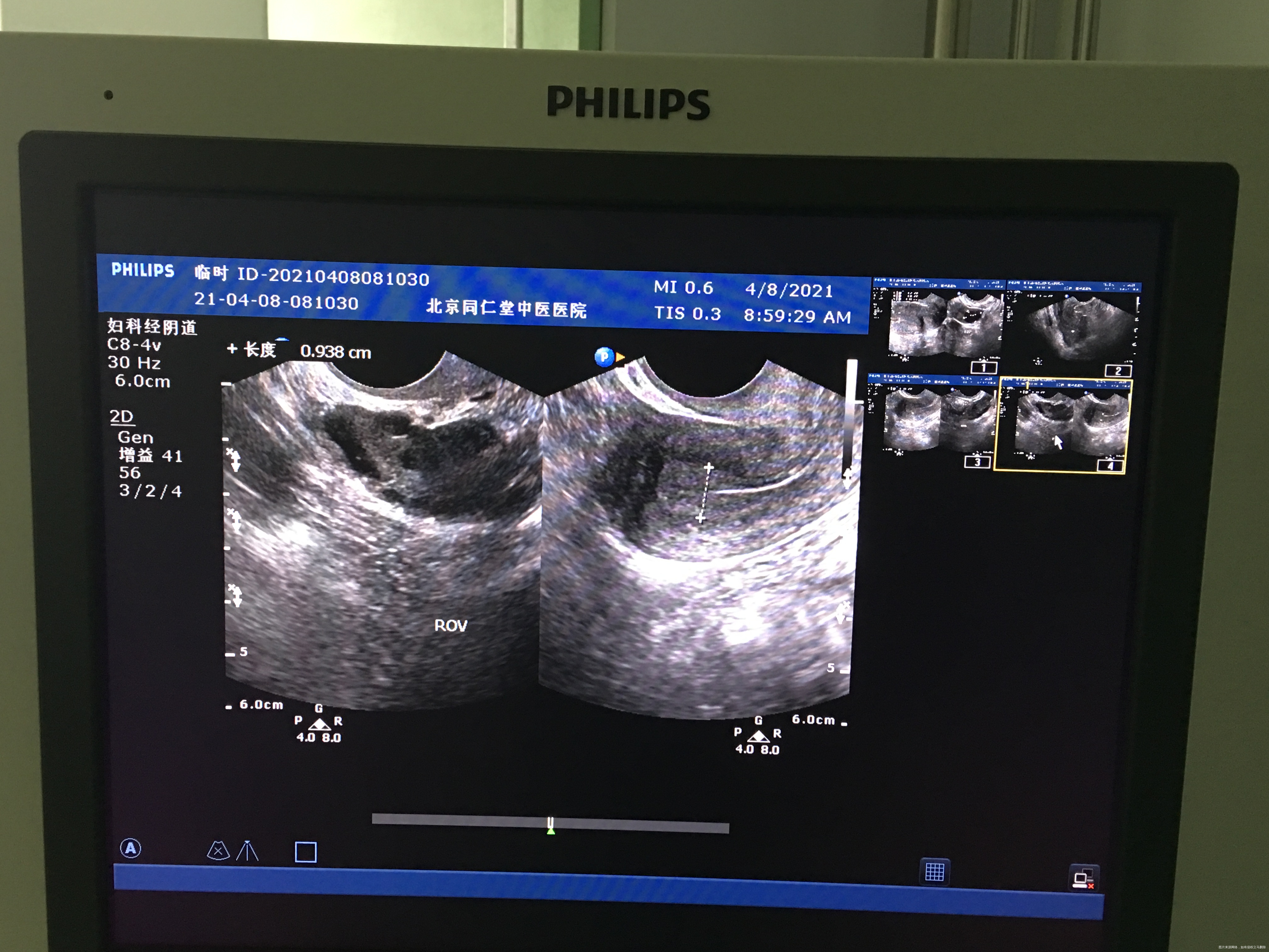 您好我月经不规律上次月经3月2日请问我现在这