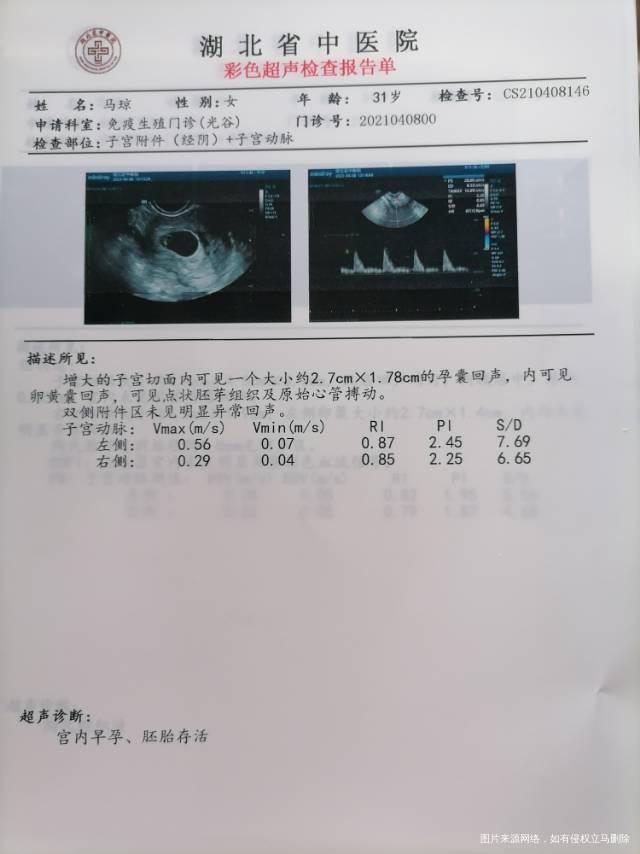 在孕七周胎停过一次这次怀孕在孕6周左右查的子