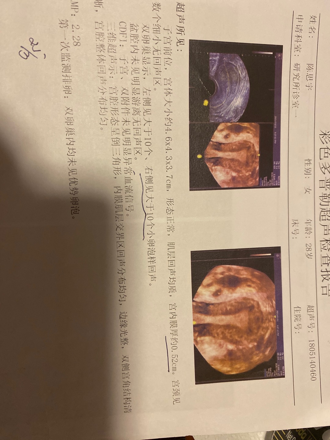 医生您好麻烦您帮我看一下我做的三维彩超报告是