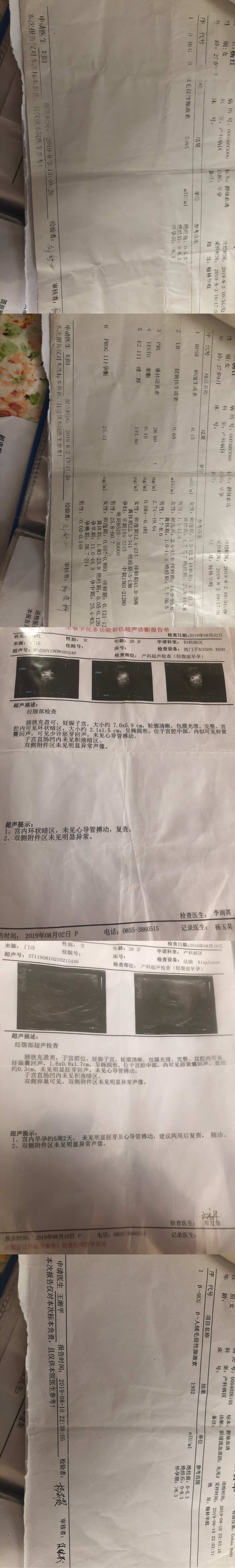前3张检查是19年8月前后第一次怀孕先兆流产