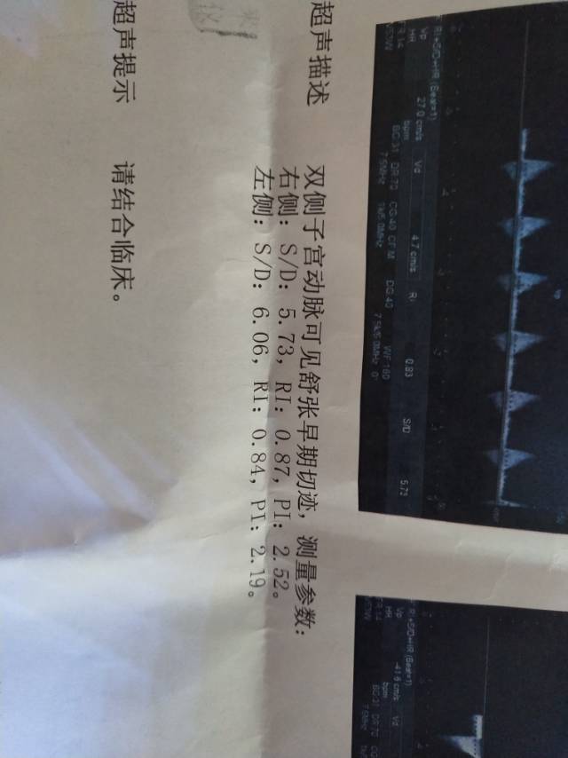 例假第14天做的请问有问题吗