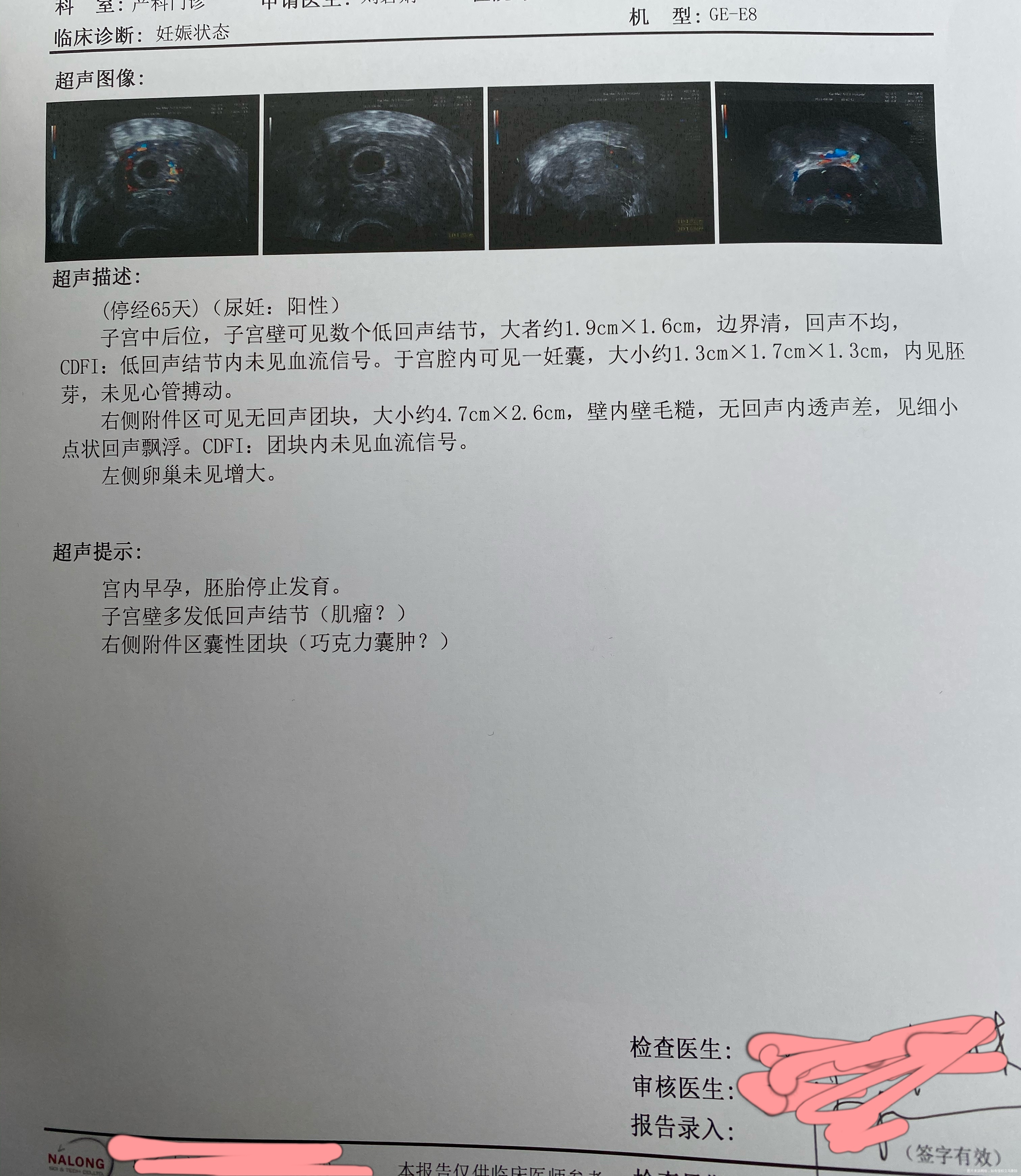 医生晚上好我是2月1日末次月经第一次自怀HC