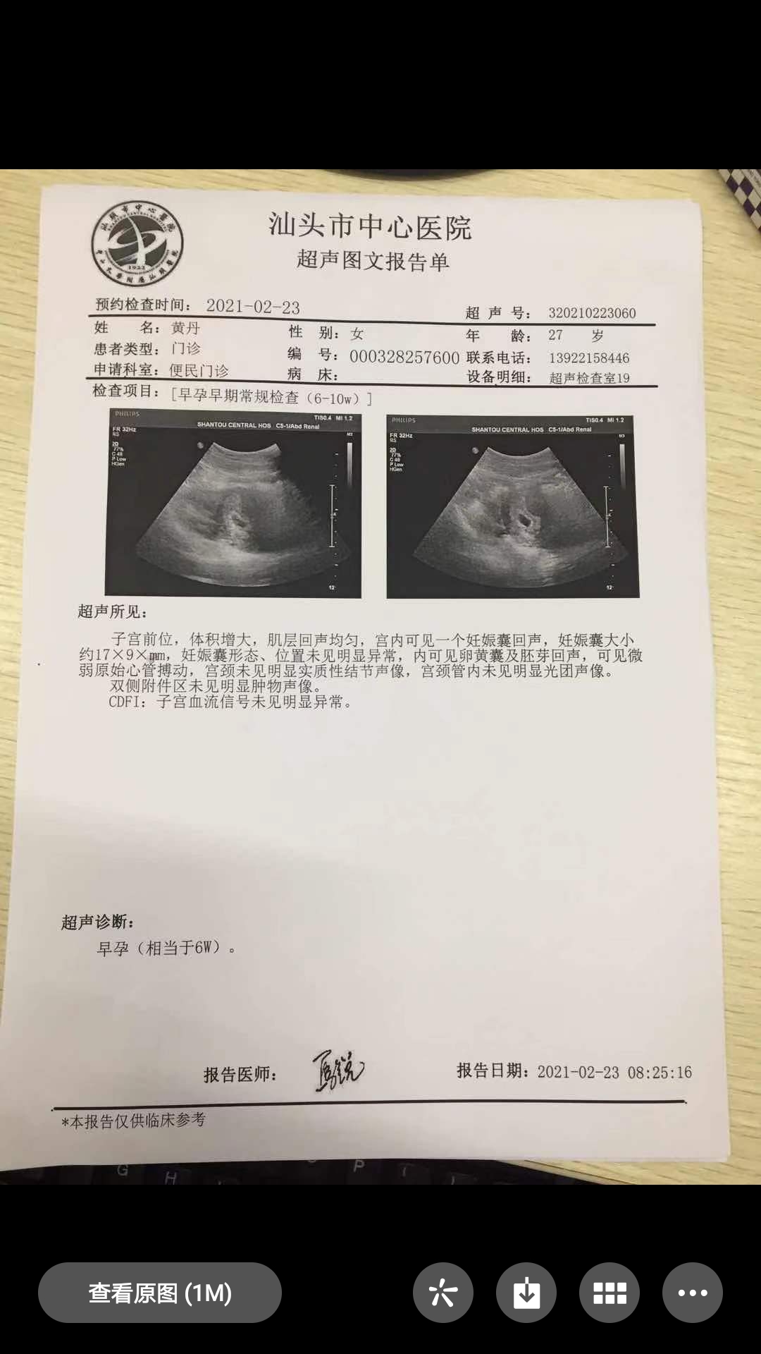 末次月经是202115孕6周时查出胎心胎芽h