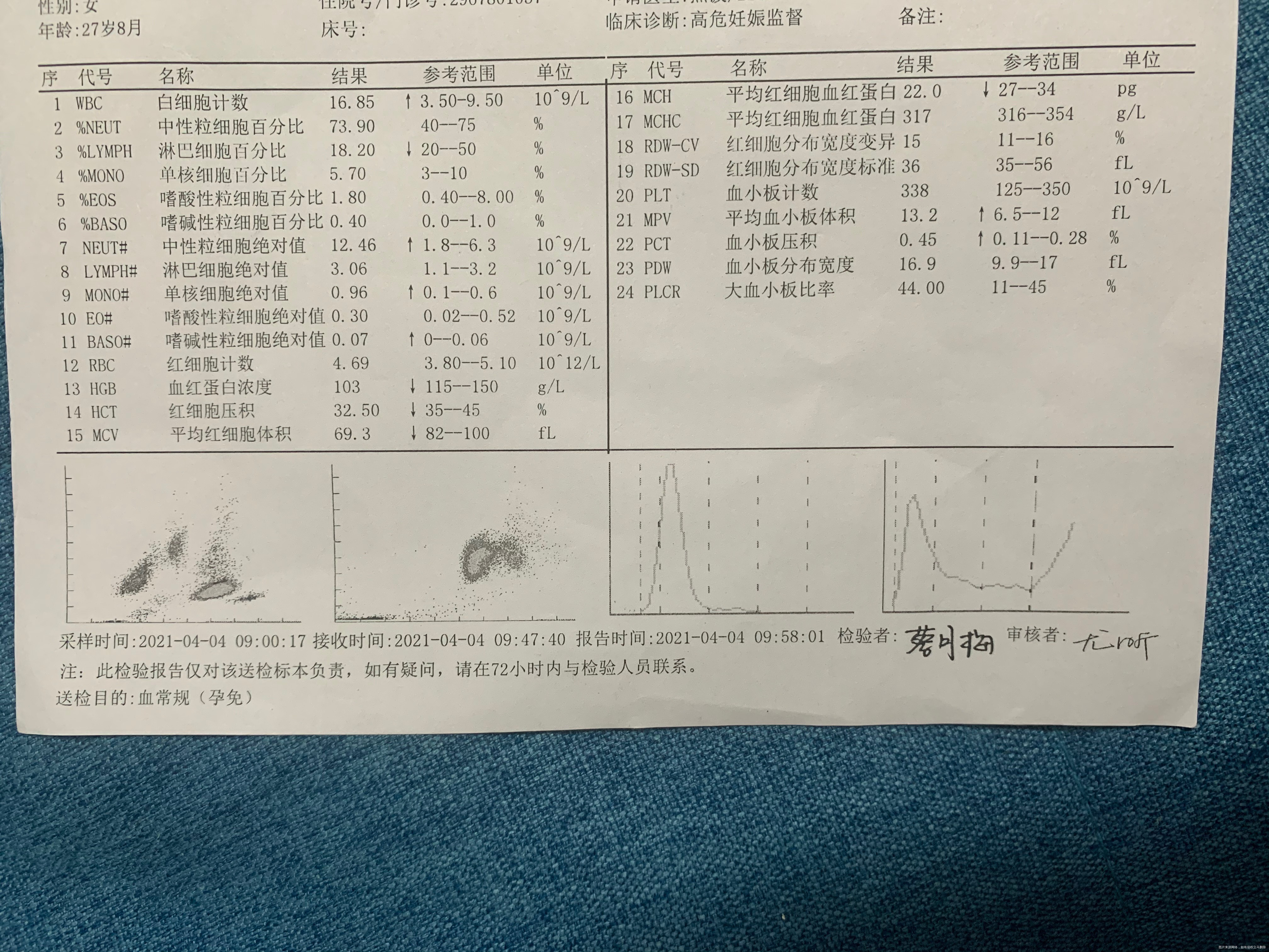 我有轻型的地中海贫血老公没有然后现在孕中期做