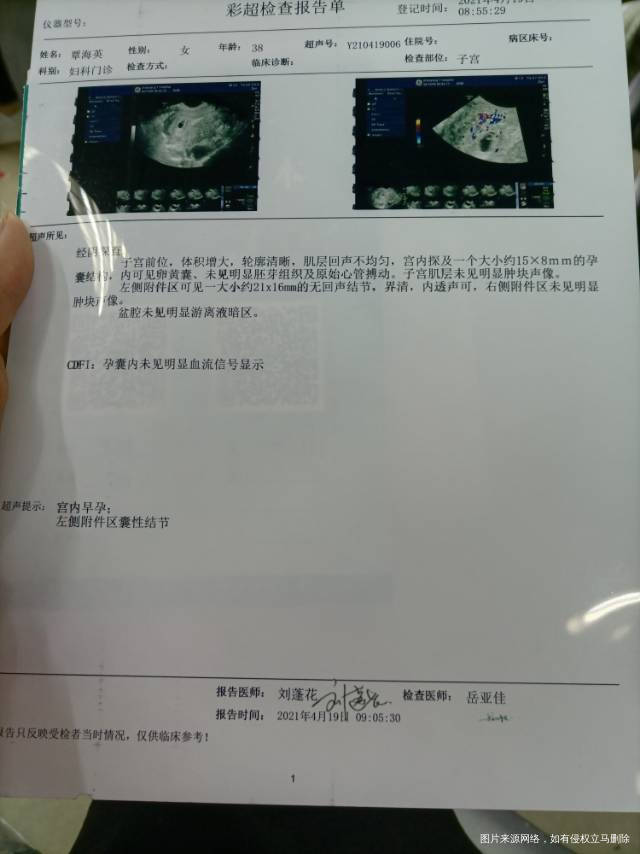 医生您好这是自己怀孕的不知道检查结果好不好好