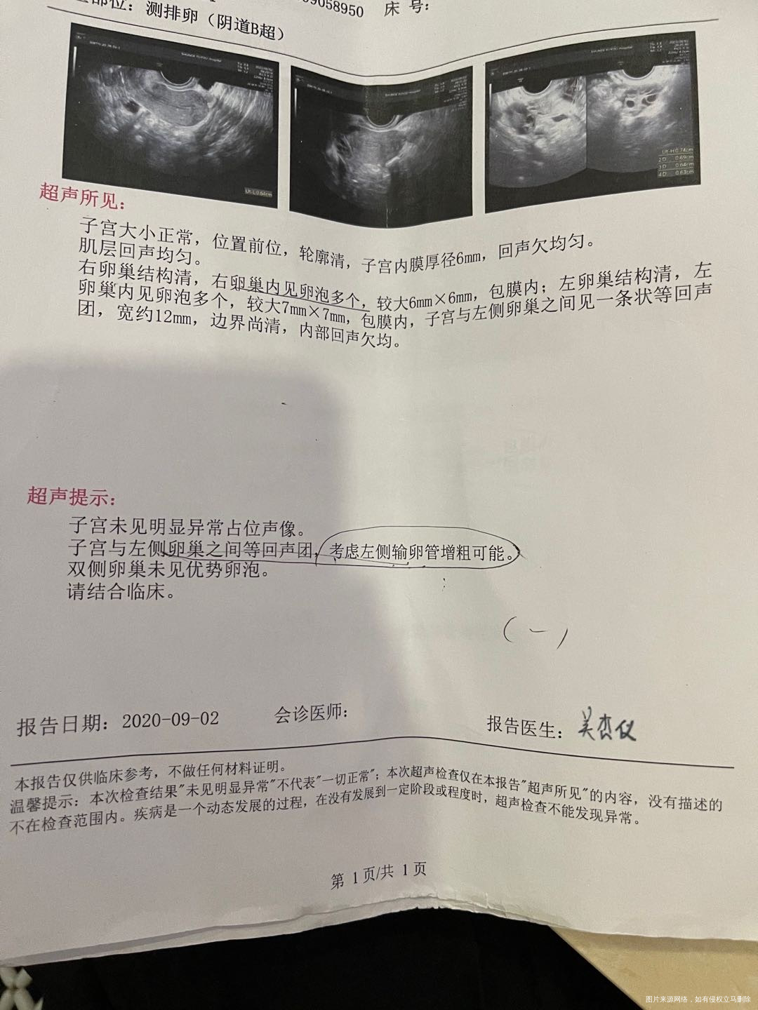 多囊卵巢综合症的患者想要生小孩是不是必须要促
